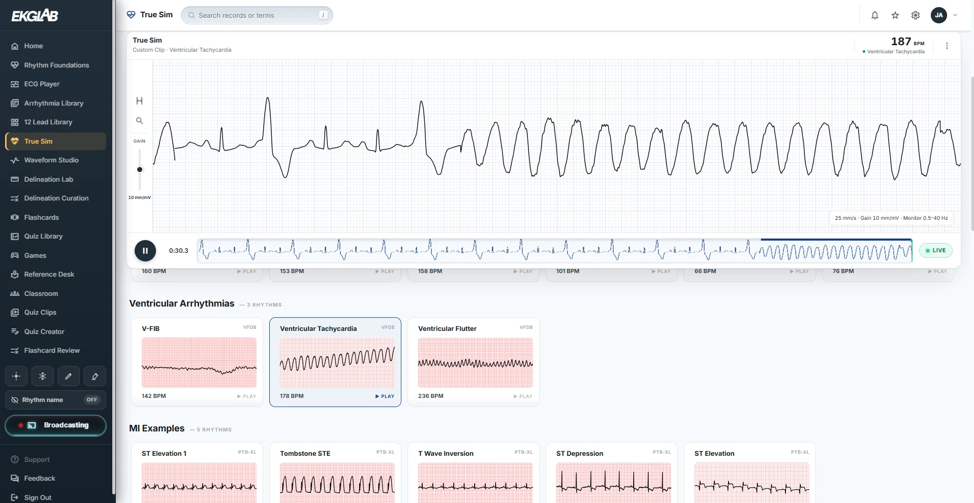 True Sim on an instructor's laptop while broadcasting: a real recording of ventricular tachycardia playing on the live sweep at 187 bpm, the clip tape below it, and the clip library of real rhythms grouped into ventricular arrhythmias and MI examples, each tagged with its source database.